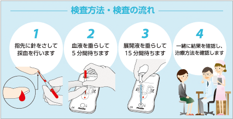 花粉症の治療方法